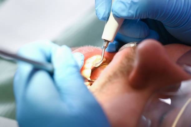 Best Urgent Care for Lost Fillings or Crowns in Henning, TN